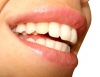 Зъбният камък може да предизвика заболяване на венците